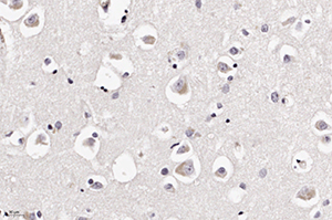 Патоморфологические изменения головного мозга при COVID-19
Патоморфологические изменения головного мозга при COVID-19