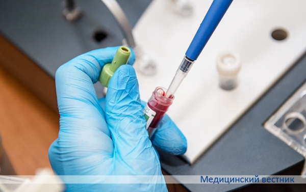 
        Почему не получается коагулограмма			    