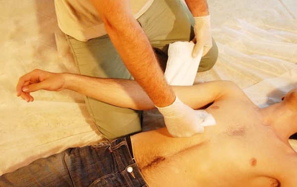 Первая помощь при острой кровопотере и травматическом шоке
Первая помощь при острой кровопотере и травматическом шоке