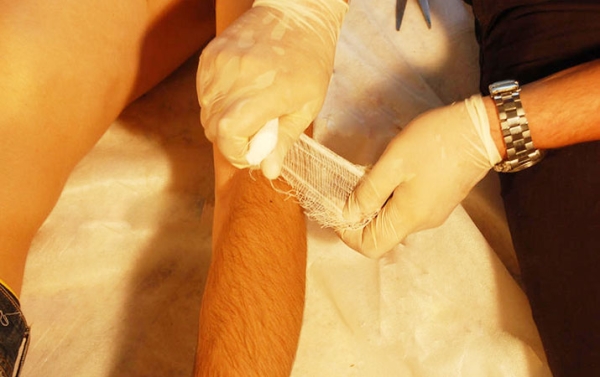 
        Первая помощь при острой кровопотере и травматическом шоке			    