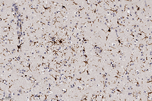 Патоморфологические изменения головного мозга при COVID-19
Патоморфологические изменения головного мозга при COVID-19