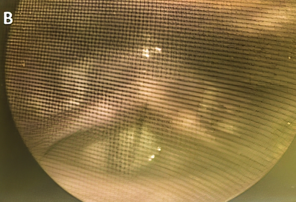 
        Нарушения голоса у пациентов с СOVID-19			    