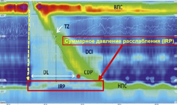 Манометрия пищевода высокого разрешения			     
        Манометрия пищевода высокого разрешения