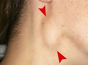 Возвращение туляремии…Что следующее?
Возвращение туляремии…Что следующее?