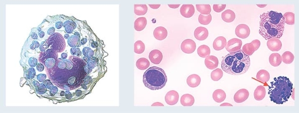 
        Лейкоцитоз. Как правильно сдать анализ крови и расшифровать результат? 			    
