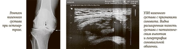 
        Патология суставов: кого направить на ультразвук			    