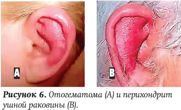 Ребенок с лор-патологией на приеме у ВОП и педиатра
Ребенок с лор-патологией на приеме у ВОП и педиатра
