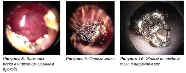 
        Ребенок с лор-патологией на приеме у ВОП и педиатра			    