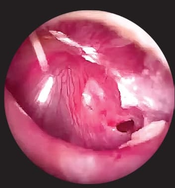 Ребенок с лор-патологией на приеме у ВОП и педиатра
Ребенок с лор-патологией на приеме у ВОП и педиатра