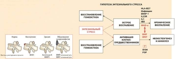 
        Псориатический артрит: диагностика и тактика ведения пациента			    