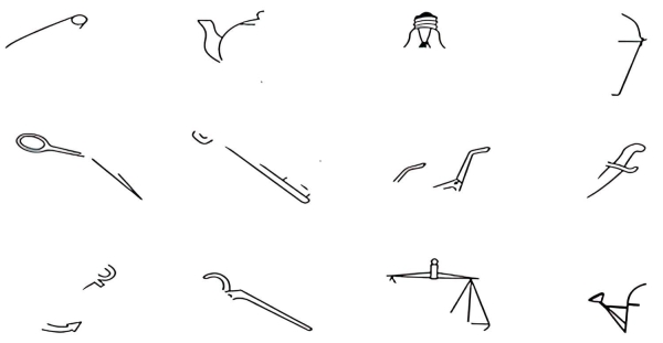 
        Распознать вовремя. Ранняя диагностика болезни Альцгеймера                    