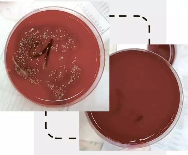 Простые правила для профилактики                     
        Простые правила для профилактики