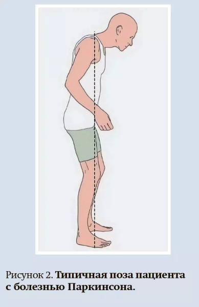 Ранние стадии болезни Паркинсона: диагностика и лечение + аудио                
        
         
        Ранние стадии болезни Паркинсона: диагностика и лечение + аудио